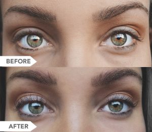 BIOLUMA Eyelash Growth Serum Before and After