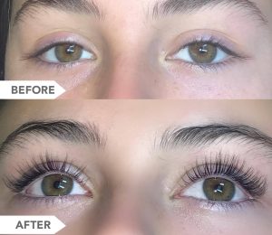 BIOLUMA Eyelash Growth Serum Before and After