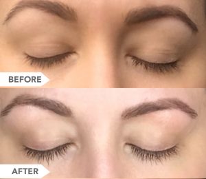 BIOLUMA Eyelash Growth Serum Before and After